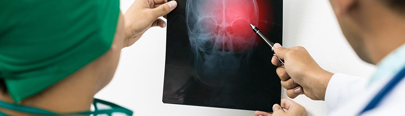 brain injury