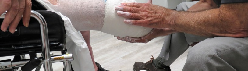 Amputation Injury Lawyers in Baltimore